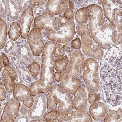 SLC16A4 Antibody, Novus Biologicals:Antibodies:Primary Antibodies